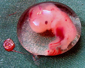 297px-Human_Embryo_-_%28cropped%29.JPG